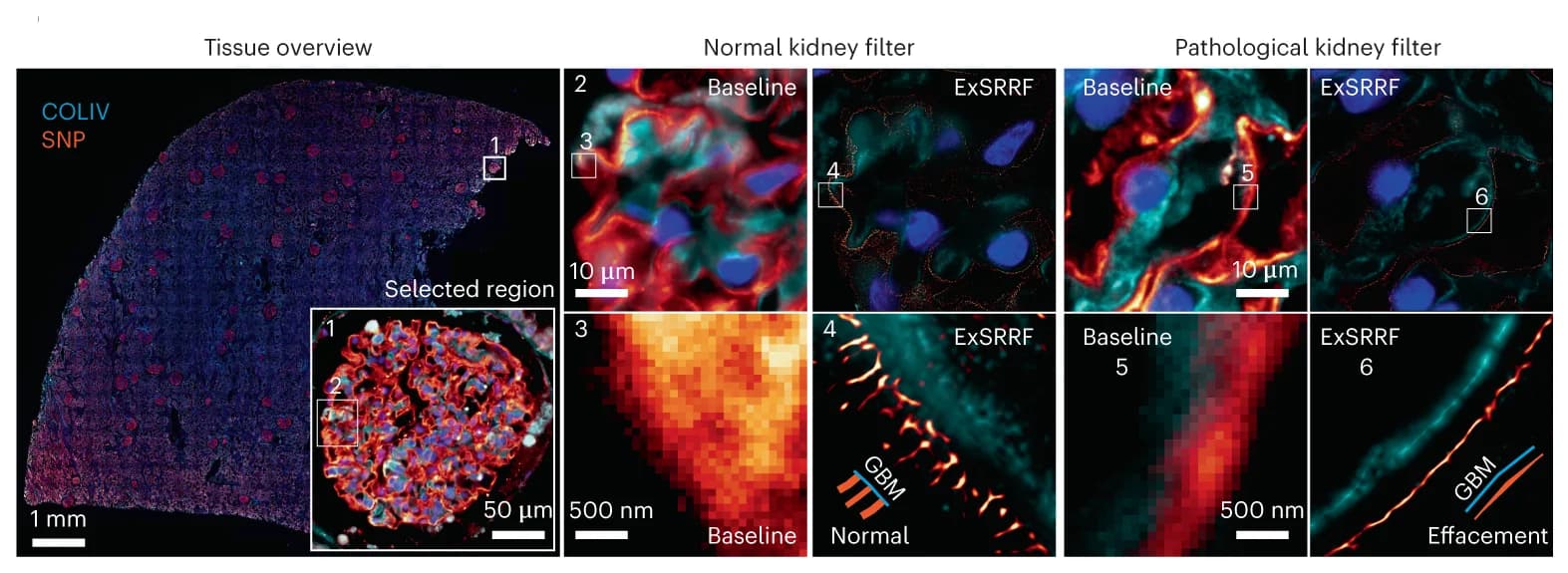 Open access visualization of Microscopy, ExSRRF, Foot Process, Synaptopodin, Collagen IV