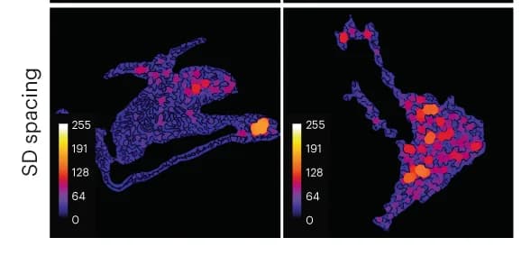 Open access visualization of Heatmap, Image Analysis, Nanoscale Morphometrics, Spacing, Immunoglobulin A Nephropathy