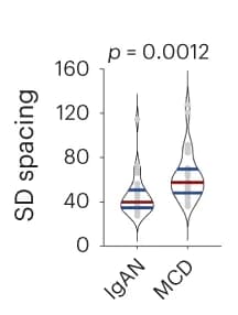 Open access visualization of Violin Plot, Image Analysis, Nanoscale Morphometrics, Spacing, Immunoglobulin A Nephropathy