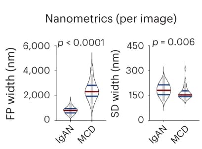 Open access visualization of Violin Plot, Foot Process Width, Slit Diaphragm Width, Immunoglobulin A Nephropathy, Minimal Change Disease