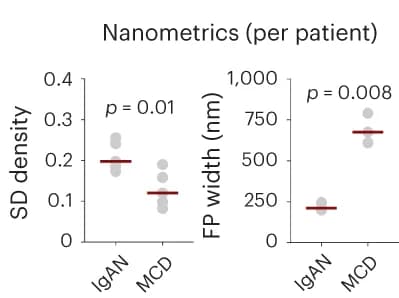Open access visualization of Scatter Plot, Nanometrics, Slit Diaphragm Density, Foot Process Width, Wide Field Images