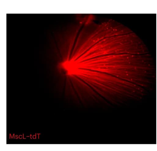 Open access visualization of Microscopy, In Vivo, Retinal fundus image, MscL-tdTomato expression