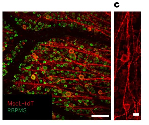 Open access visualization of Microscopy, Confocal stack projections, RGC layer, Flat-mounted retina