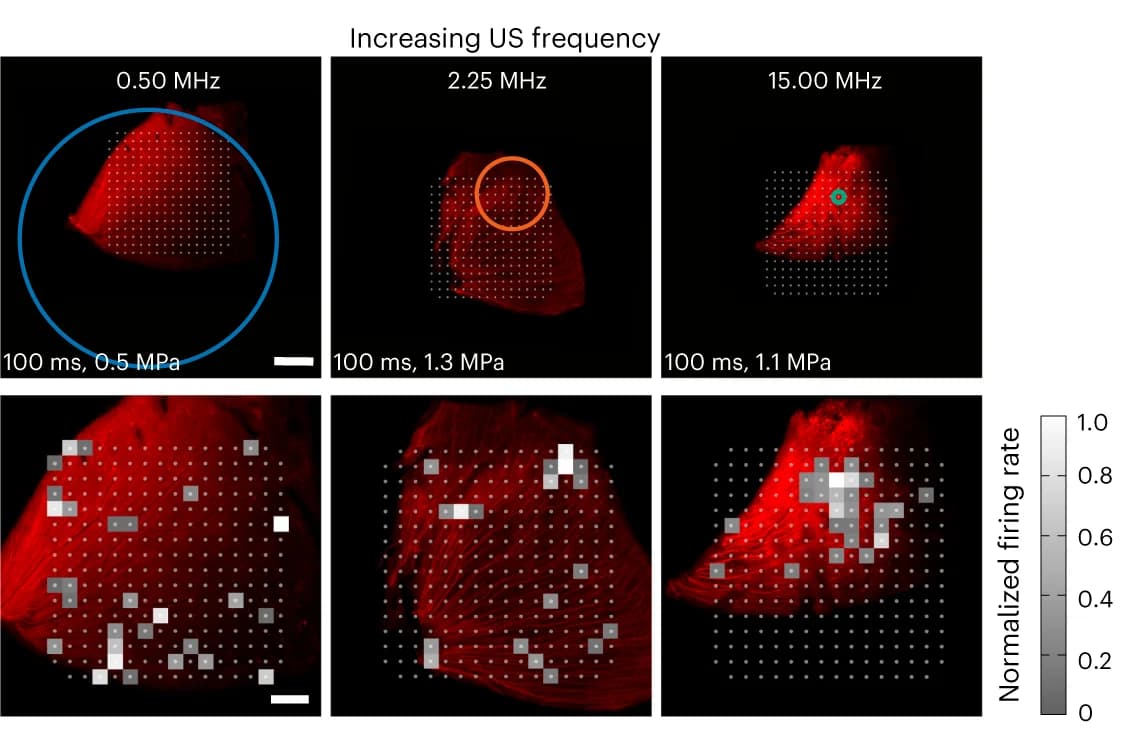 Open access visualization of Microscopy, Retinas, MEA Chip, US Pressure Beam, Activation Maps