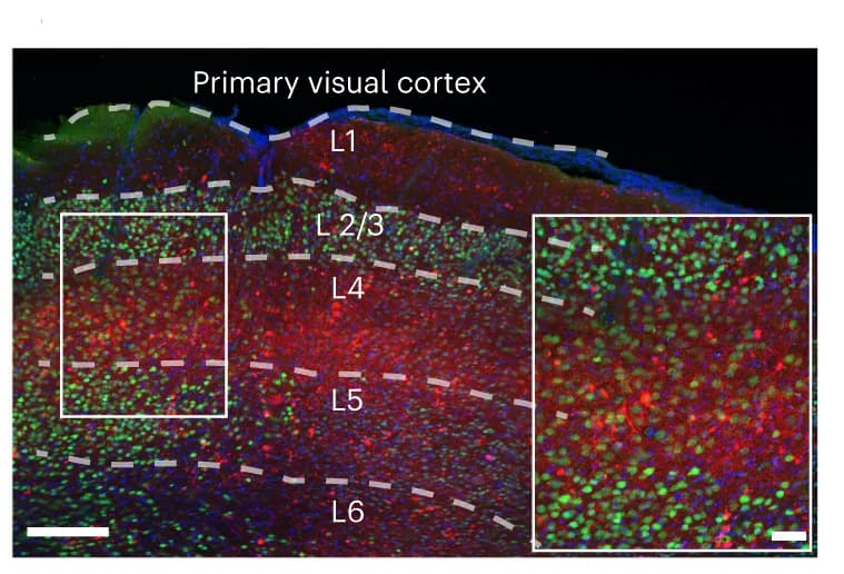 Open access visualization of Microscopy, Confocal Microscopy, Sagittal Brain Slice, MscL-tdTomato, NeuN Antibody