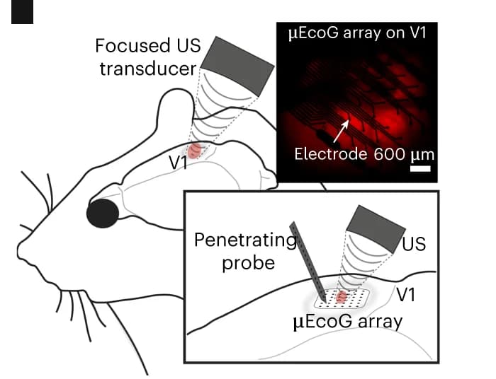 Open access visualization of Illustration, Microscopy, Cortical Potentials, Visual Evoked Potentials, Sonogenetic Evoked Potentials