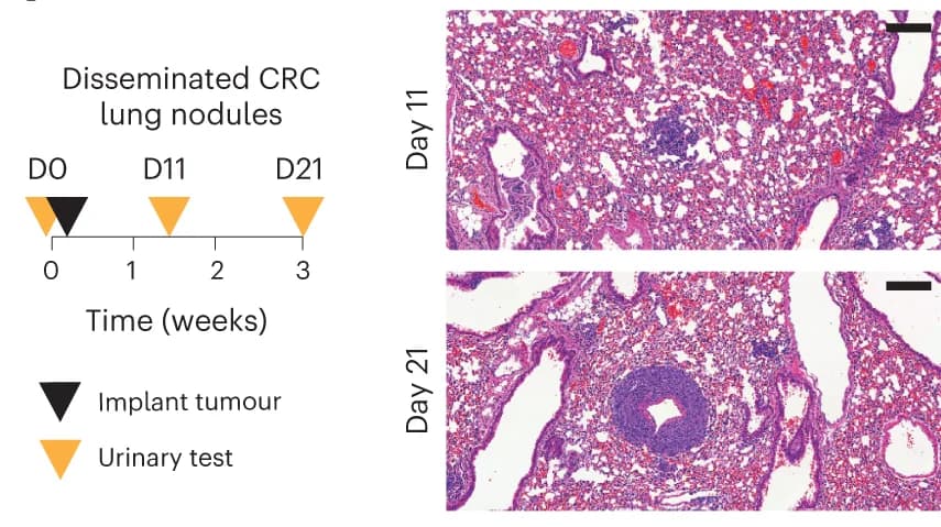 Open access visualization of Microscopy, Illustration, Tumor Monitoring, DNA-SUB, Lung Staining