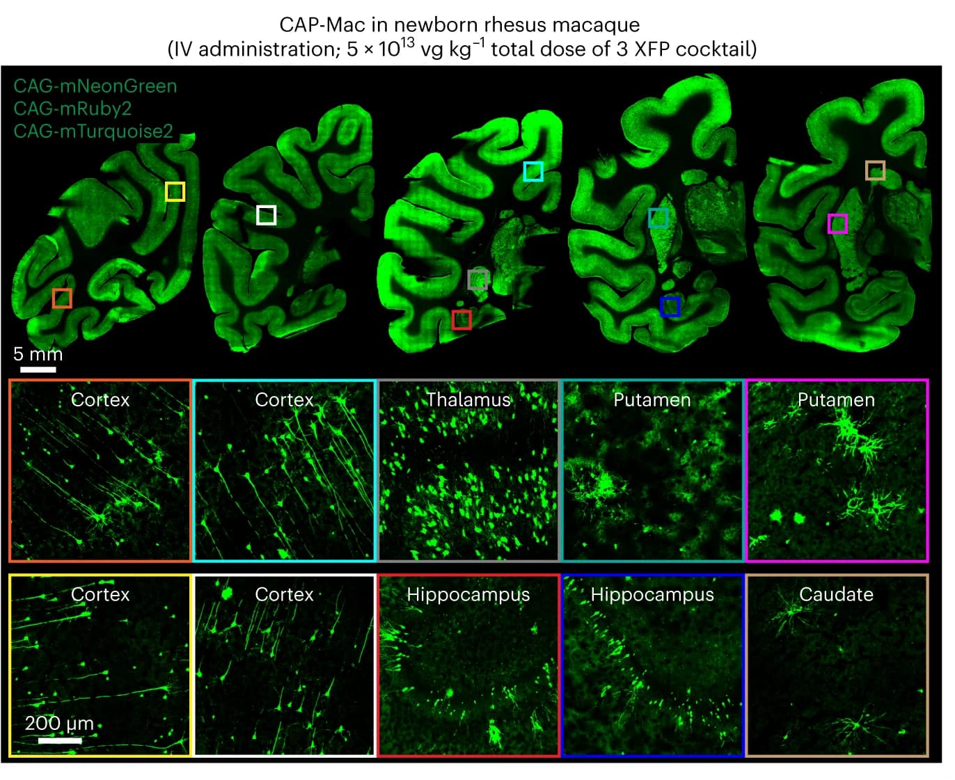 Open access visualization of Microscopy, CAP-Mac expression, Rhesus Macaques, Fluorescent Reporter Expression, Cortical Brain Regions