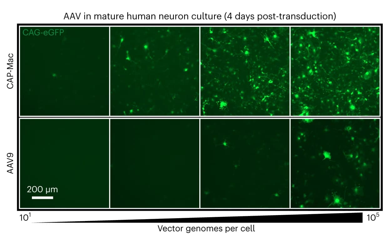 Open access visualization of Microscopy, Cultured Human Neurons, CAP-Mac, AAV9, ssCAG-eGFP