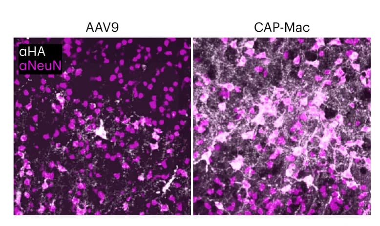 Open access visualization of Microscopy, CAP-Mac, Transduction, Neurons, Grey Matter