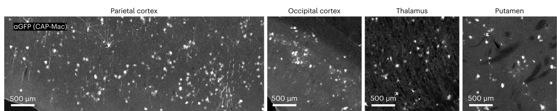 Open access visualization of Microscopy, CAP-Mac, eGFP Expression, GFP Antibody, Amplification