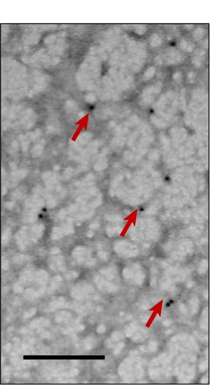 Open access visualization of Microscopy, TEM, Immuno-gold-stained TSAM, pGEL proteins, Gold Particles