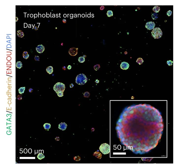 Open access visualization of Microscopy, Trophoblast Organoids, DyNAtrix, GATA3, E-cadherin