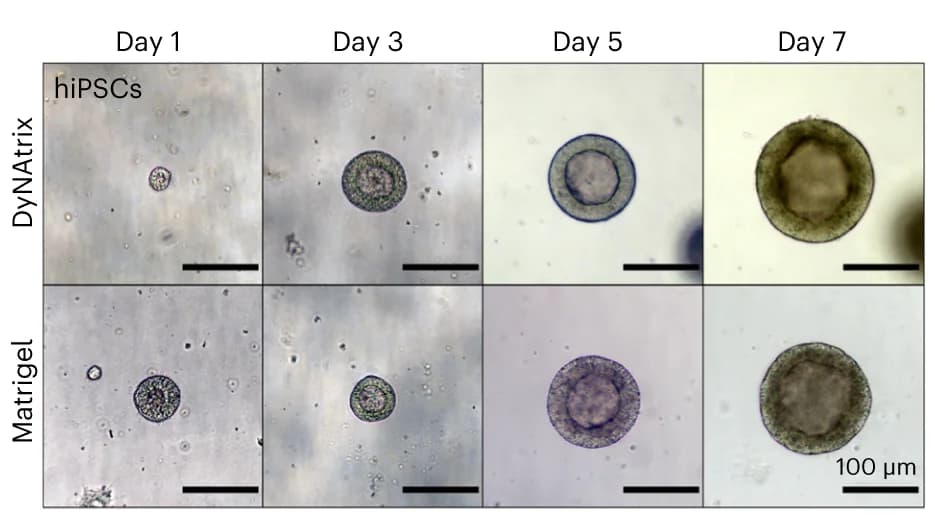 Open access visualization of Microscopy, Photo, hiPSC Cysts, DyNAtrix, Matrigel