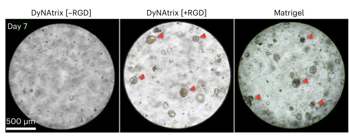Open access visualization of Microscopy, Photo, Trophoblast Organoids, DyNAtrix, Matrigel