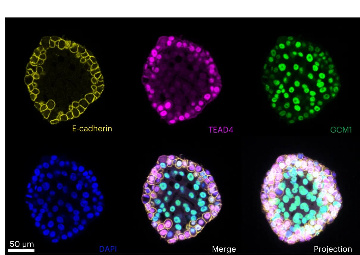 Open access visualization of Microscopy, Trophoblast Organoid, DyNAtrix, TEAD4, E-cadherin