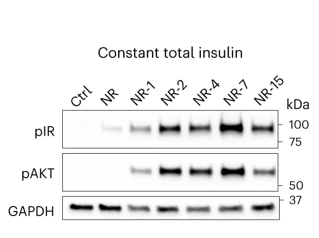 Open access visualization of Gel, Western Blot, Phosphorylated IR, Adipocytes, Insulin