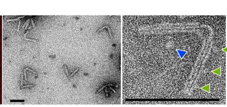 Open access visualization of Microscopy, TEM, Nanoengine, Negative staining, Streptavidin