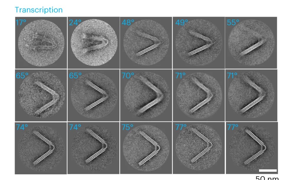 Open access visualization of Microscopy, 2D Averages, Micrographs, Particles, Opening Angles