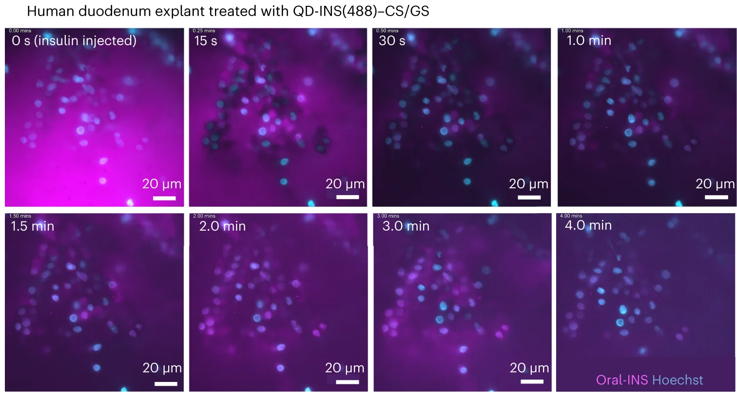 Open access visualization of Microscopy, Time-Lapse Imaging, Duodenum Explants, QD-INS-Conjugated Alexa Fluor 488, CS/GS Coating