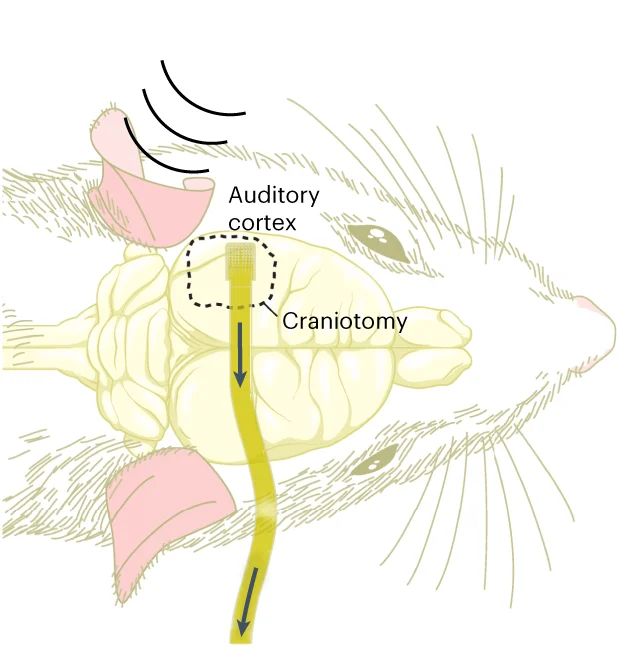 Open access visualization of Illustration, EGNITE microECoG, Flexible Array, Epicortical Neural Activity, Rat