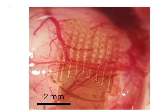 Open access visualization of Photo, EGNITE microECoG, Auditory Cortex, Rat