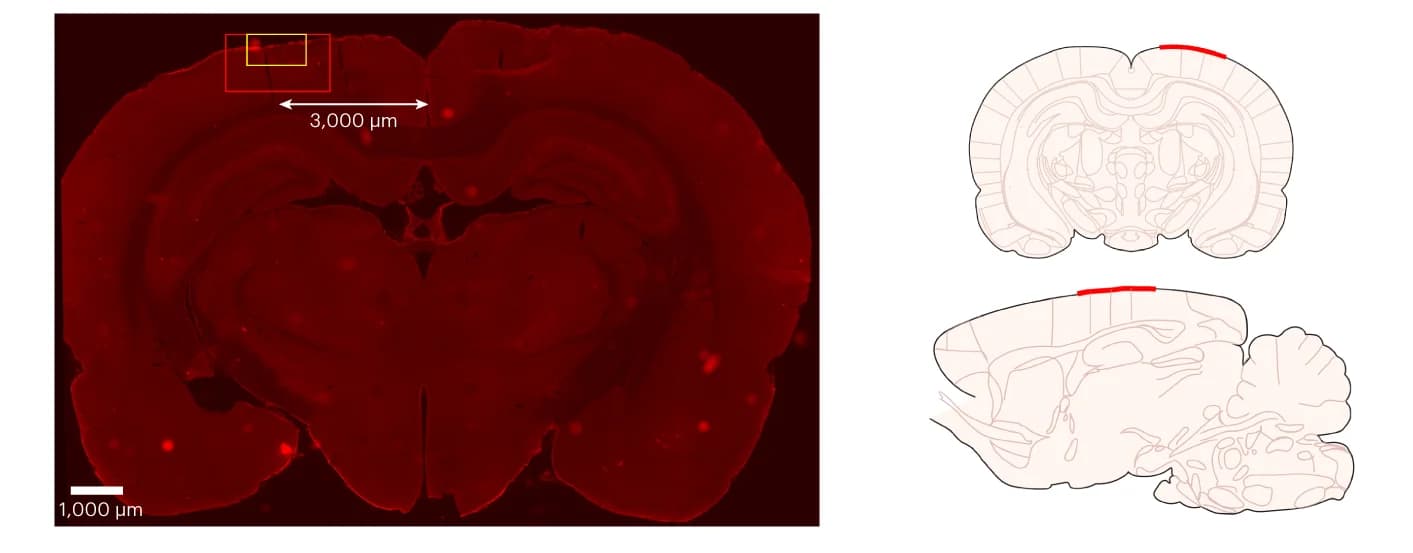 Open access visualization of Microscopy, Illustration, Brain Section, Immunohistochemistry, Microglia