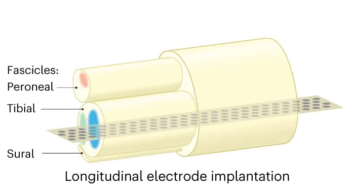 Open access visualization of Illustration, Peripheral Nerve, Tissue Response, Biocompatibility, PI Device