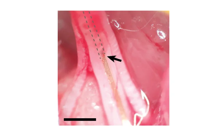 Open access visualization of Photo, Optical Micrograph, Device Implantation, Sciatic Nerve, Rat