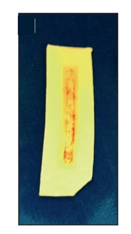 Open access visualization of Photo, Porcine Strip, Blood Adhesion, Blood Flow