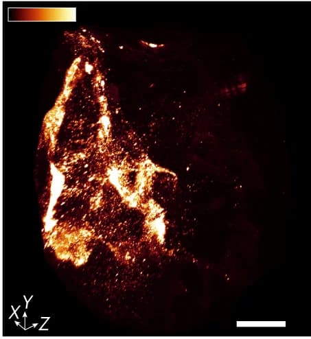 Open access visualization of Microscopy, Maximum Intensity Projection, Nanobots