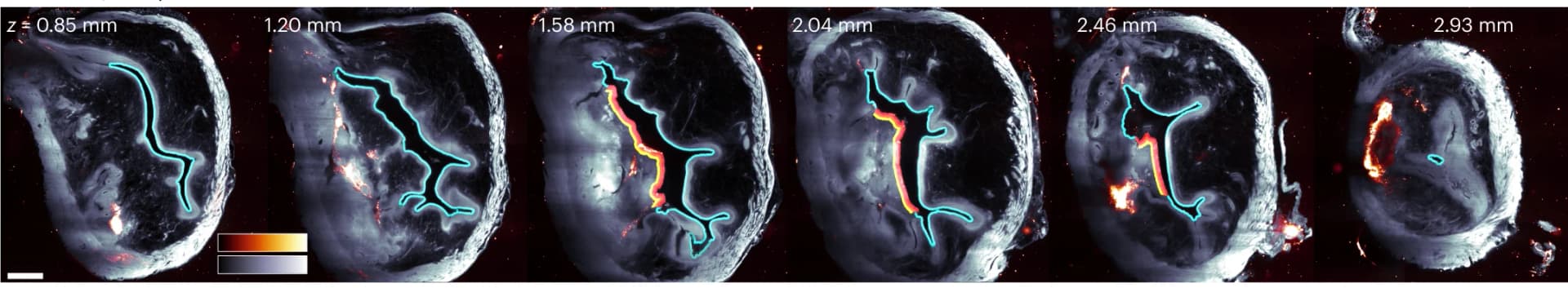 Open access visualization of Microscopy, Optical Sections, Tissue Layers