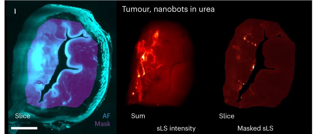 Open access visualization of Microscopy, Tumor in Bladder, Nanobots, Urea, Autofluorescence