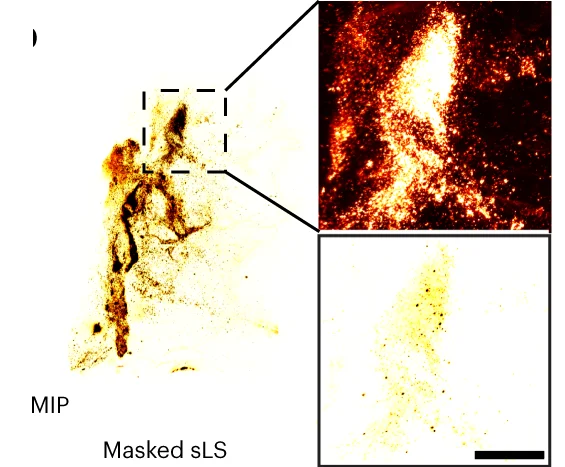 Open access visualization of Microscopy, Tumor in Bladder, Nanobots, Urea, Autofluorescence