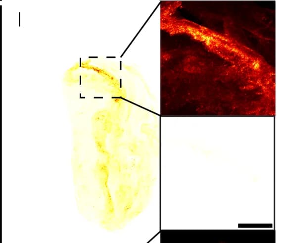 Open access visualization of Microscopy, Tumor in Bladder, Nanobots, Water, Autofluorescence