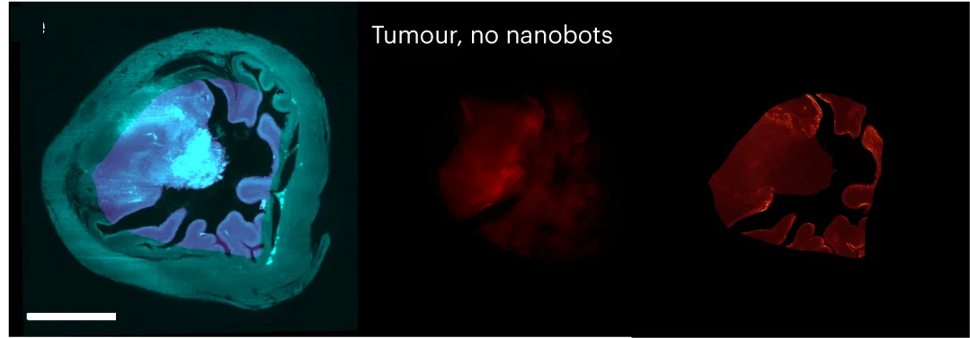 Open access visualization of Microscopy, Tumor in Bladder, No Nanobots, Autofluorescence, V-LS