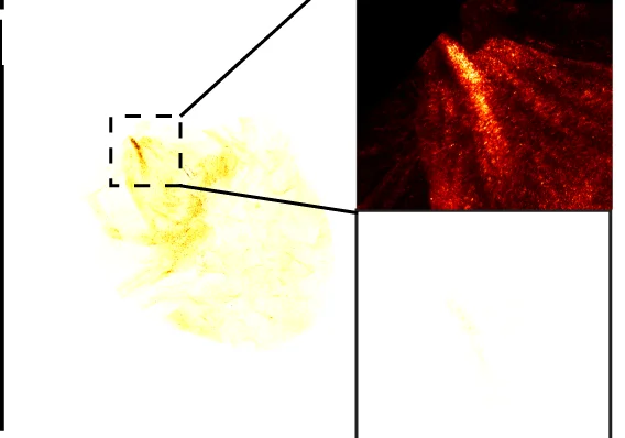 Open access visualization of Microscopy, Tumor in Bladder, No Nanobots, Autofluorescence, V-LS