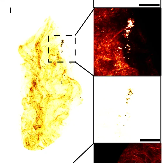 Open access visualization of Microscopy, Healthy Bladder, No Tumor, Nanobots, Urea