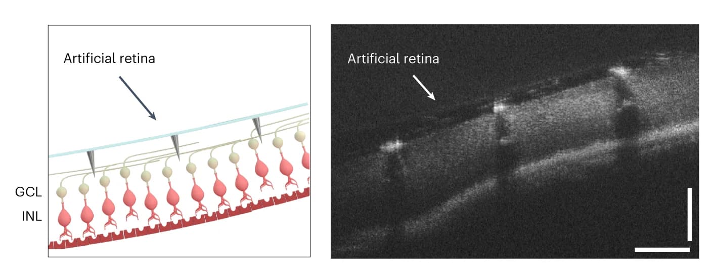 Open access visualization of Microscopy, Illustration, Schematic, Optical Coherence Tomography, Retina