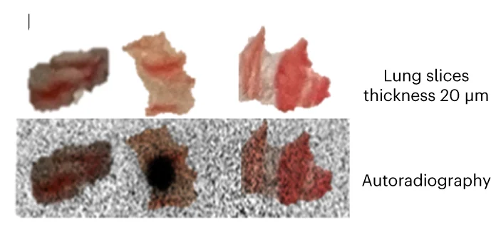 Open access visualization of Photo, Autoradiography, Lung Slices, Radioactivity