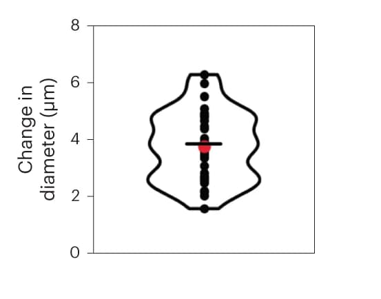 Open access visualization of Violin Plot, Soma Diameter, Compression