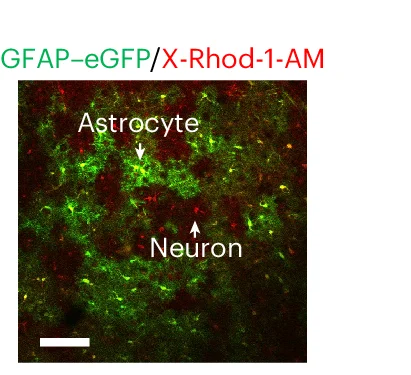 Open access visualization of Microscopy, Confocal Microscopy, Fluorescence Microscopy, Astrocytes, Neurons