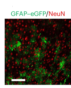 Open access visualization of Microscopy, Immunohistochemistry, Astrocytes, Neurons, GFAP