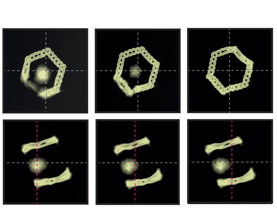 Open access visualization of Microscopy, p97, 3D Electron Density Map, Asymmetric Shape