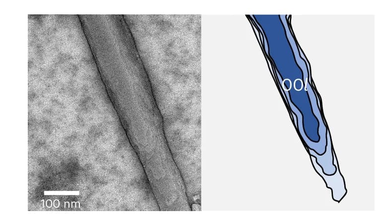 Open access visualization of Microscopy, Illustration, TEM Micrograph, Single-Crystalline Fibre, Crystal Facet
