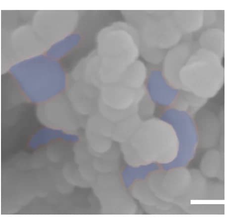 Open access visualization of Microscopy, Fluorescent Images, Primary Hippocampal Neurons, Voltron 2.0, JF585