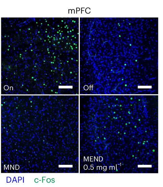 Open access visualization of Microscopy, Confocal Images, Quantification, c-Fos-expressing Neurons, mPFC