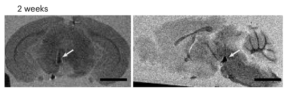 Open access visualization of Microscopy, MRI, Brain, Mice, MEND Injections