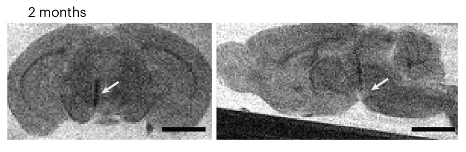 Open access visualization of Microscopy, MRI, Brain, Mice, MEND Injections