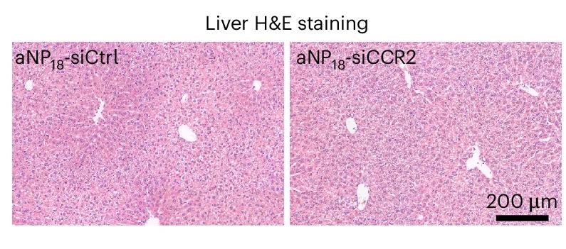 Open access visualization of Microscopy, Liver Sections, Hematoxylin and Eosin, aNP-siRNA